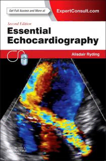 Download Essential Echocardiography PDF by Alisdair Ryding